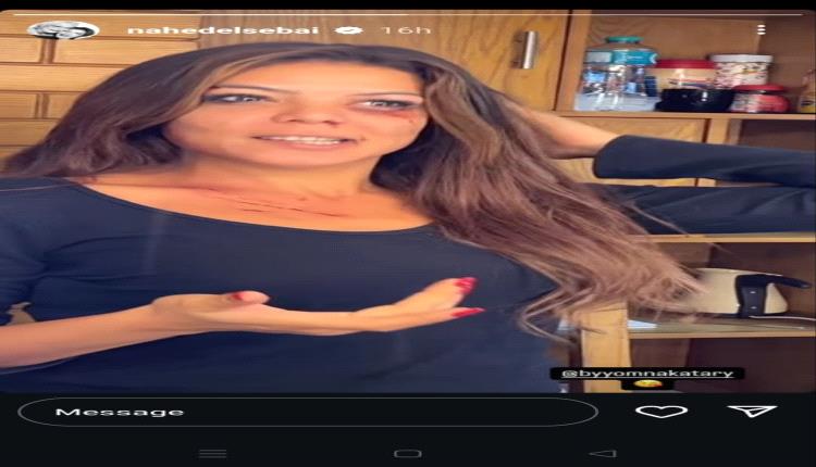 ما سبب ظهور ناهد السباعي بكدمات ودماء على وجهها؟
