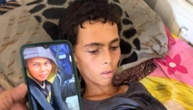 بعد وفاة طفل جديد..ارتفاع الوفيات بسوء التغذية في غزة إلى 162
