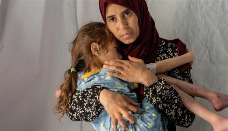 4 وفيات جديدة ترفع حصيلة ضحايا تجويع غزة إلى 317 وفاة
