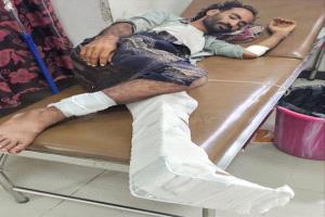 قناص حوثي يصيب مواطنًا في مقبنة تعز
