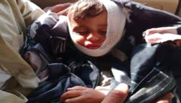 مقتل طفل بإحراق مسلحين لمنزل مواطن في تعز
