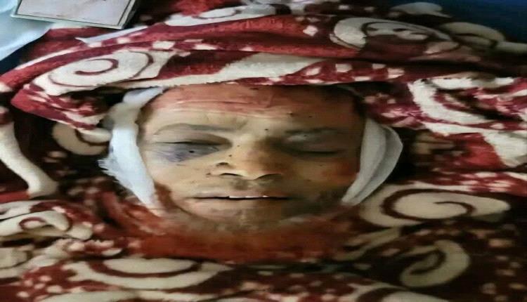 قصفوا بيته بالاسلحة الثقيلة ورفضو تسليم جثمانه .. تفاصيل جريمة الحوثي البشعة بحق شيخ القرآن "صالح حنتوس"