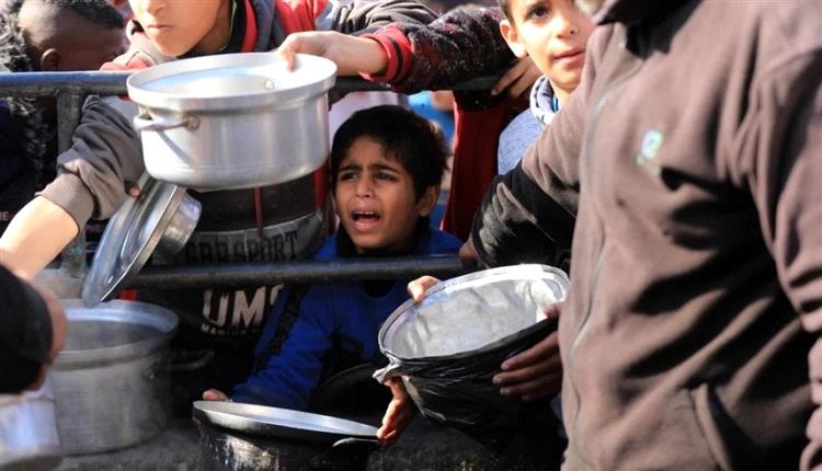 بسبب سوء التغذية..وفاة 67 طفلاً في غزة
