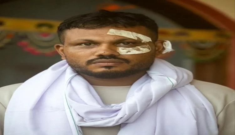 لا ينام ولا ينسى.. ماذا حدث للناجي الوحيد من الطائرة الهندية المنكوبة؟
