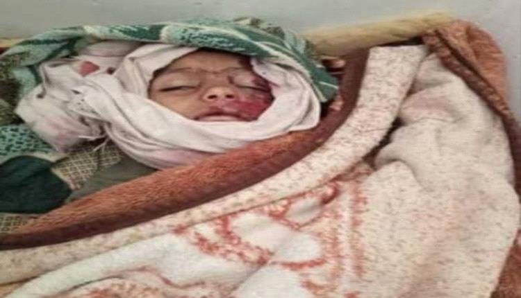 تعز .. طفل يدفع حياته ثمنًا للحصول على شربة ماء

