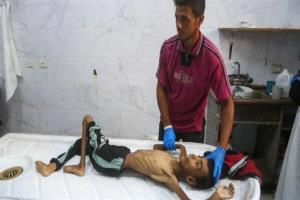 بسبب الجوع وسوء التغذية..10 وفيات جديدة في غزة

