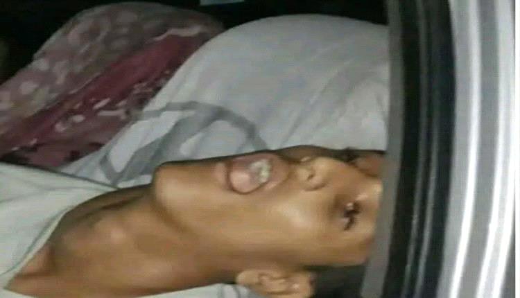الطب الشرعي يكشف ملابسات وفاة أربعة شبان في محافظة لحج
