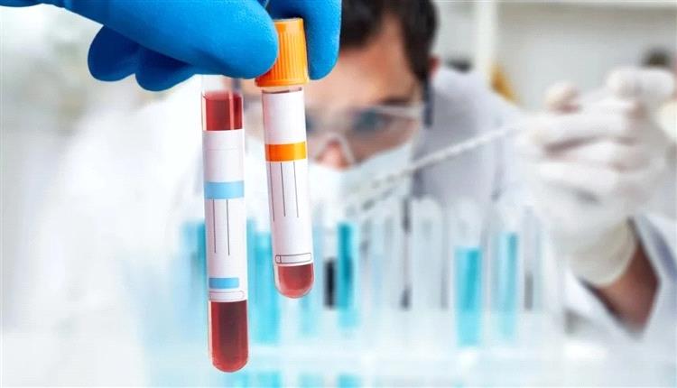 اختبار لمقاومة الإنسولين يكشف خطر الزهايمر مبكراً
